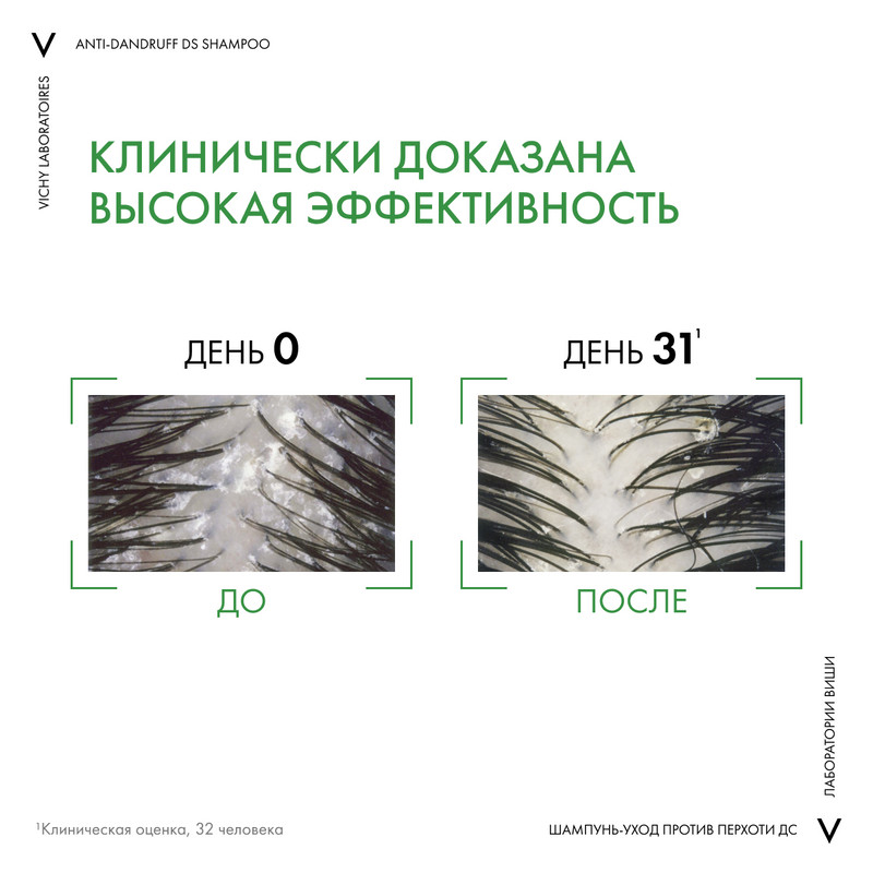 Vichy Dercos Шампунь-уход интенсивный против перхоти для нормальных и жирных волос 200 мл
