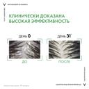 Vichy Dercos Шампунь-уход интенсивный против перхоти для нормальных и жирных волос 390 мл