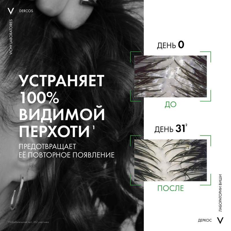 Vichy Dercos Шампунь-уход интенсивный против перхоти для нормальных и жирных волос 75 мл