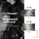 Vichy Dercos Шампунь-уход интенсивный против перхоти для нормальных и жирных волос 75 мл